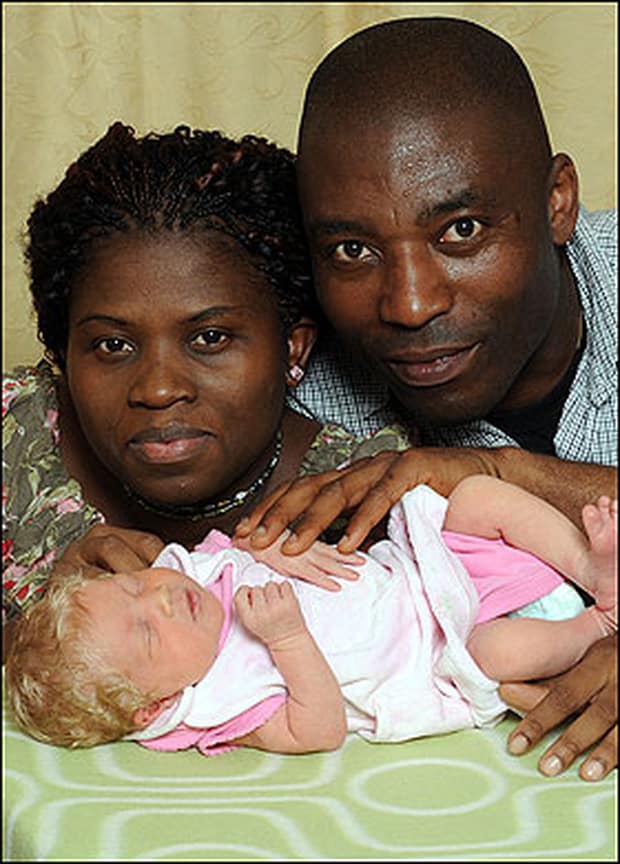Cặp vợ chồng da đen sinh con gái da trắng gây sốc, chồng tự tin: Vợ tôi ngoan lắm, chắc do bệnh thôi!